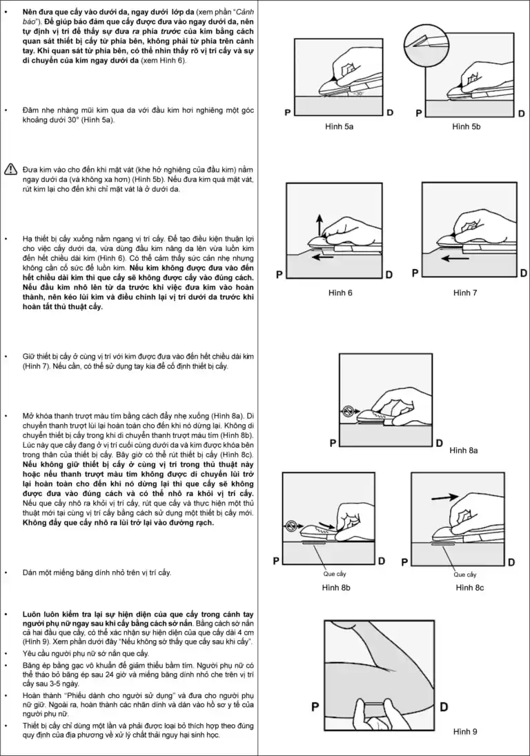 cách dùng que cấy tránh thai implanon nxt 68mg